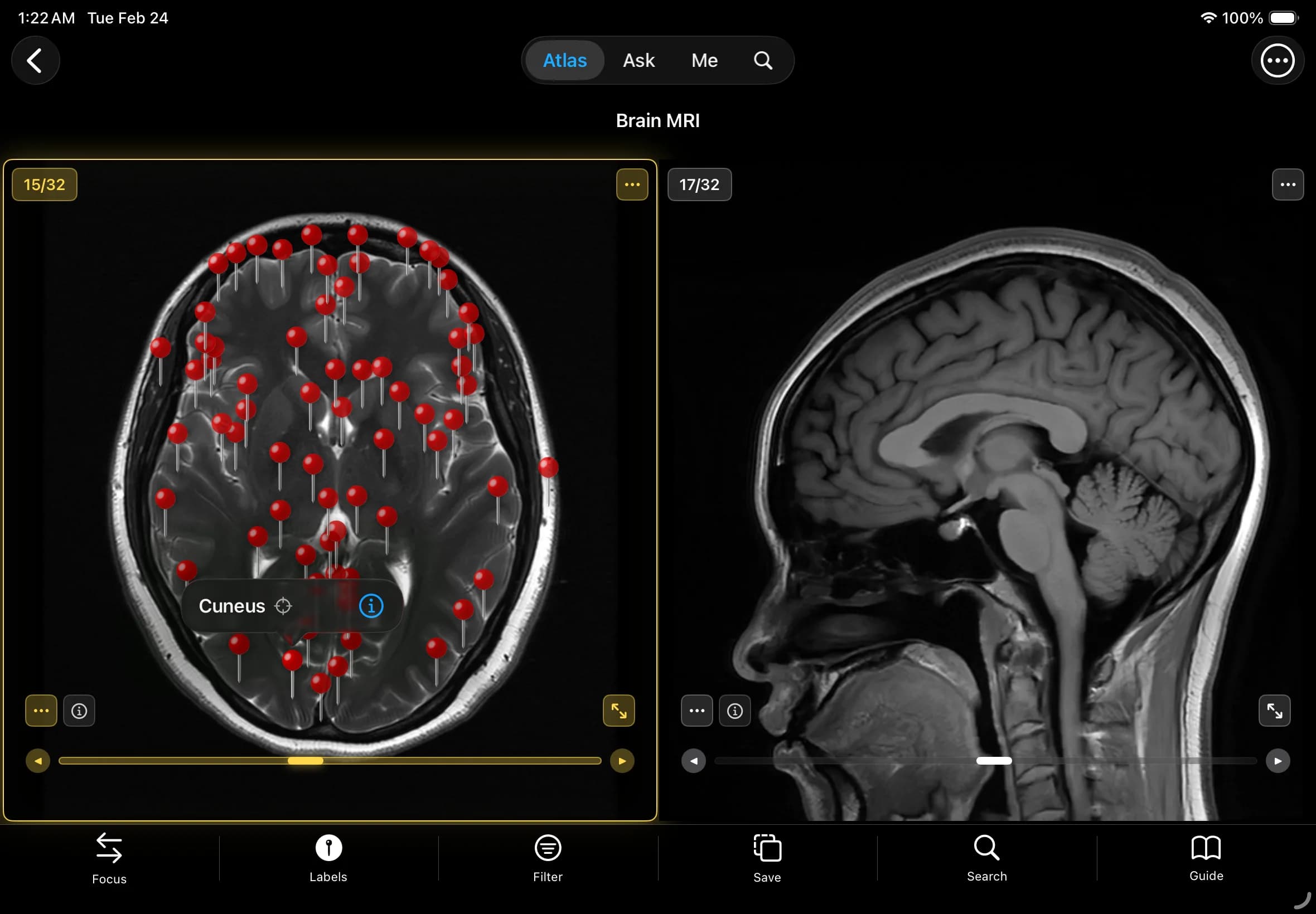 Precise & Comprehensive - 1